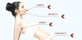 激光脱毛了为什么还是会长毛呢？