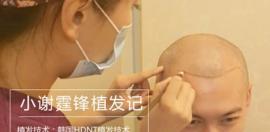 合肥维多利亚植发中心为小谢霆锋植发手术全过程