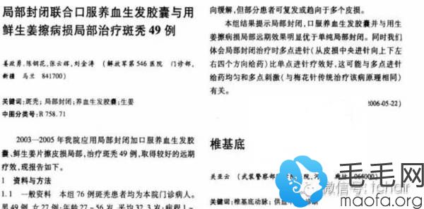 解放军第546医院用生姜擦头皮进行49例斑秃治疗研究文献