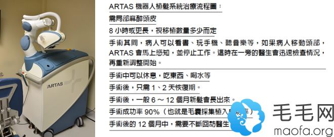 ARTAS机器人植发系统治疗流程图