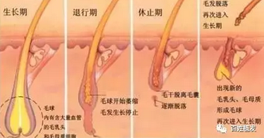 植发后2—4个月新长出的头发会脱落的原因