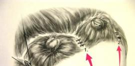 发际线怎么调整才好看？要多少钱呢？