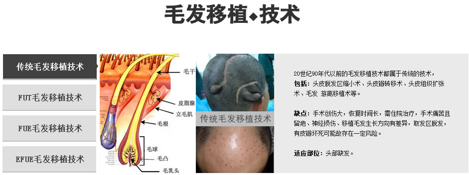 下面带大家来了解一下佳美的毛发移植技术吧~