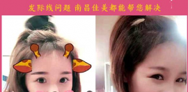 南昌佳美整形医院公司高管&校花真人PFUE无痕毛发移植日记