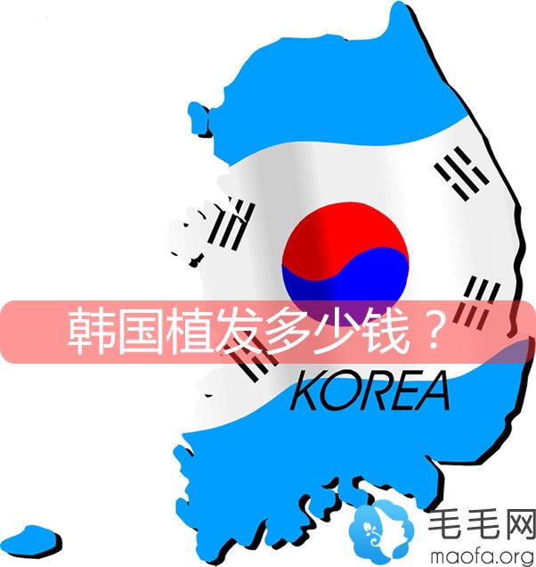 韩国植发要多少钱