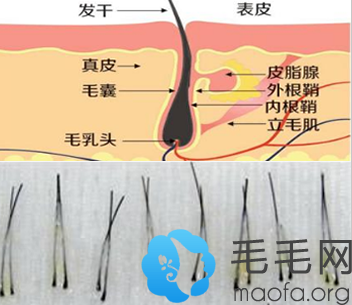 毛发种植时提取毛囊的图片