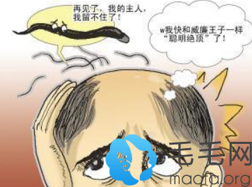 遗传性脱发通过什么方法改善呢