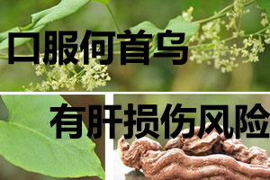 上海华美植发紧急通知：治疗脱发绝不能使用生何首乌