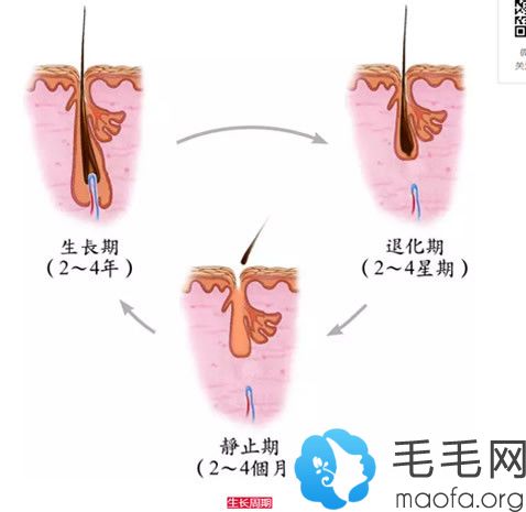 植发后头发会不会脱落