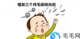 植发3个月毛囊全掉了，正常吗，我这样是不是植发失败啦？
