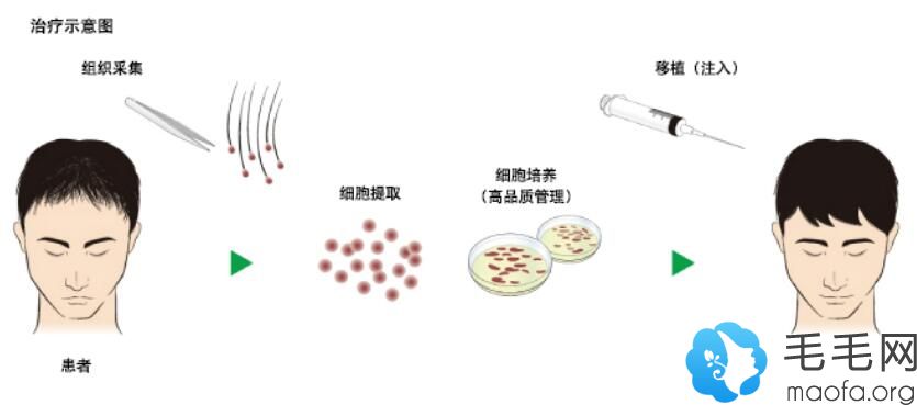 rch-01生发技术过程