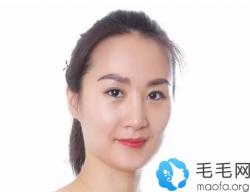 眉毛种植好吗？亲述我在成都植发医院种植眉毛亲身经历