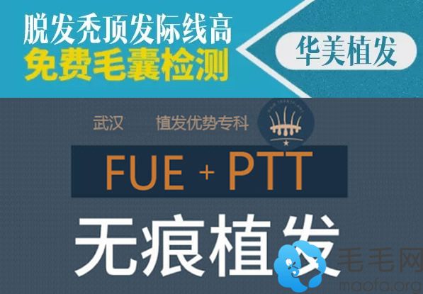 若你脱发秃顶发际线高 就来植发吧价格3.8折哦