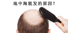 因脱发造成的地中海头发有救吗?了解脱发原因后看治疗方法