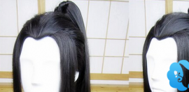 頭發(fā)種植手術(shù)讓M型發(fā)際線和美人尖之間的區(qū)別變得可逆