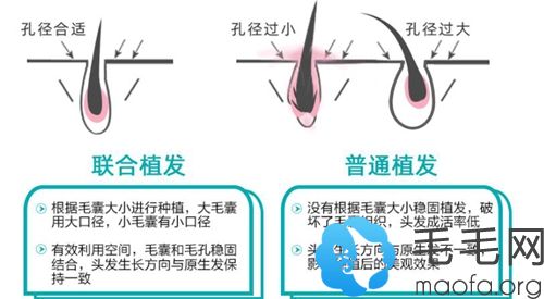 成都恒博种植技术