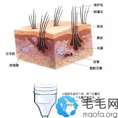 段亦棋医生毛发种植<span style=