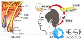 原来大家常说头发种植后太可怕竟然是因为这6大植发的危害