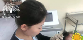 案例:瑞丽诗非手术电波密发让你摆脱头发稀疏/发缝宽等难题
