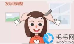 我额头发际线高还不齐，为了美才去做了fue发际线种植