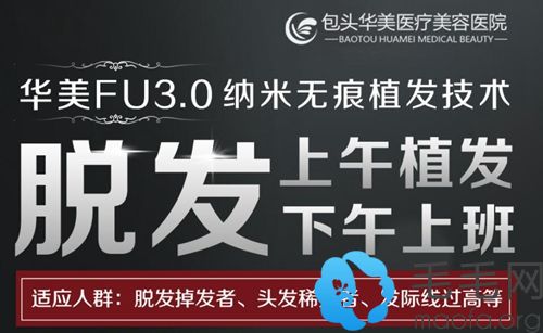 拥有专业的FU3.0微针无痕植发术