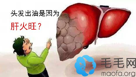 头发出油都是肝火旺惹的祸?它跟这些原因也有关系