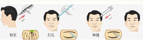 lattice点阵加密技术即插即种