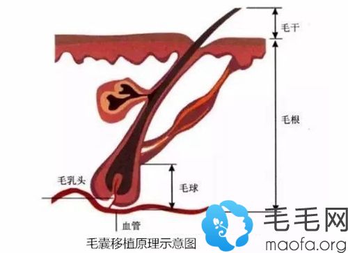 睫毛移植原理示意图