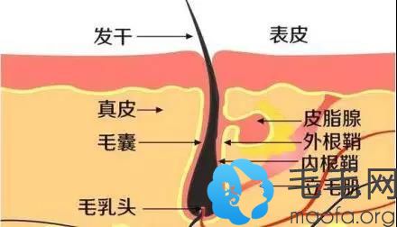 毛囊结构的示意图