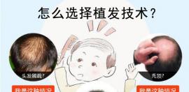 植发技术区别对比!看fue无痕种植和pse微针及ptt技术哪个好！