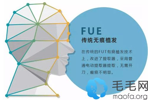 FUE无痕植发技术原理