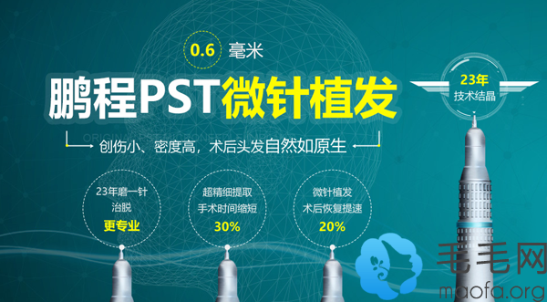 深圳鹏程PST微针植发技术