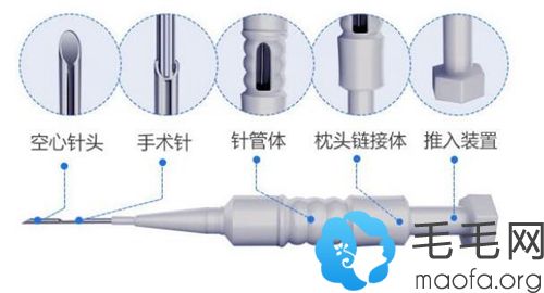 ZTC植发技术的优势特点