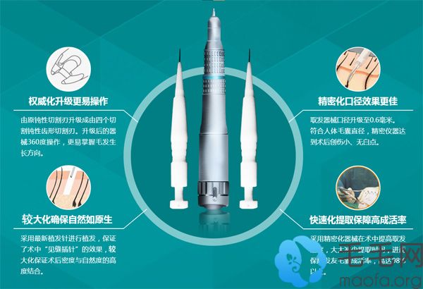 PST微针植发技术优势