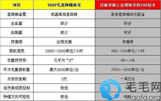 tddp植发技术和fue的区别