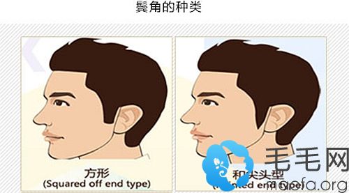 常见的鬓角种植种类