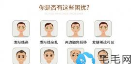 谁用过德生源育发液，能起到生发防脱的效果是真的吗?