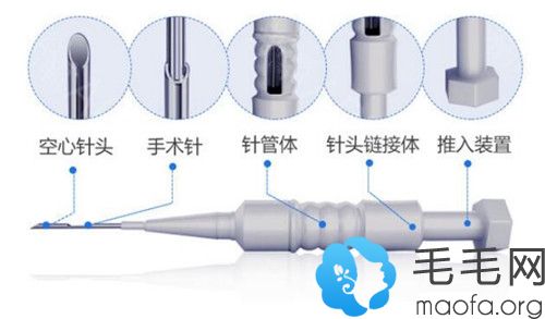 微针种植技术的手术原理