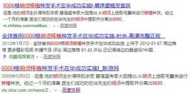 络腮胡能用来植发吗?胡子移植到头上韩国江南NHI植发就做过