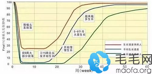 移植毛囊的生长周期示意图