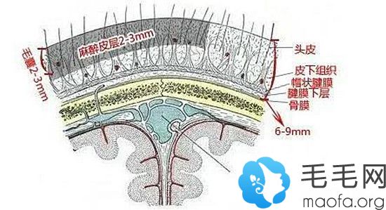 手术是在浅表层操作