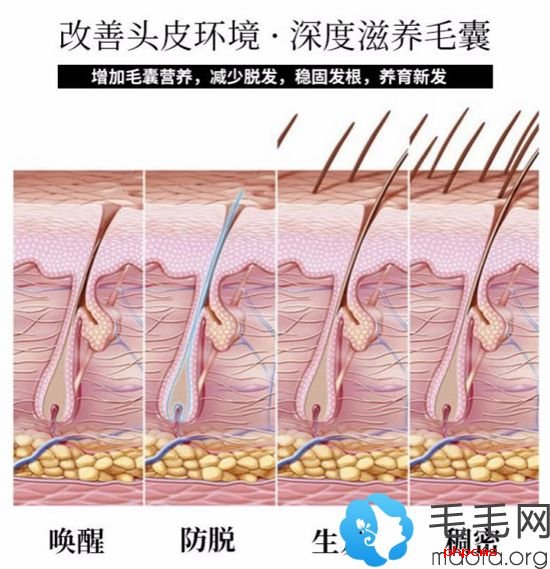 只能起到改善头皮环境滋毛囊
