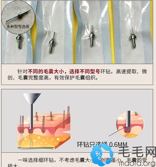 技术先进，种植过程精细操作