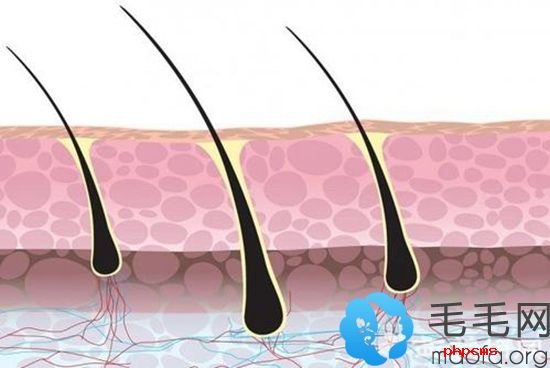 植发两三年基本脱落的原因