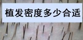植发密度多少合适?原来植发45/50/55/60的密度不同效果也不同