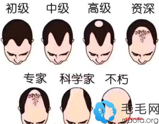 程序员脱发等级示意图