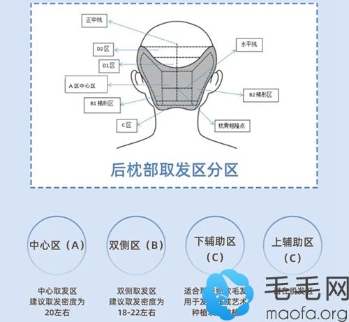 后枕部取发区分区设计