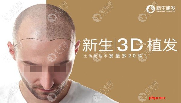 新生专属的3D植发技术