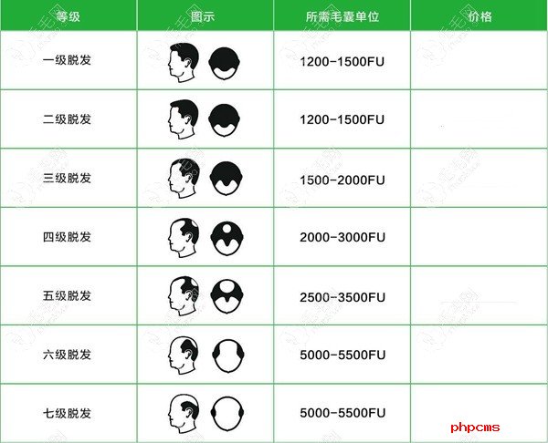 男士m型发际线脱发分级图