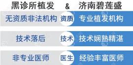 碧莲盛济南分院尹梓贻医生植发靠谱收费透明,避免被坑！